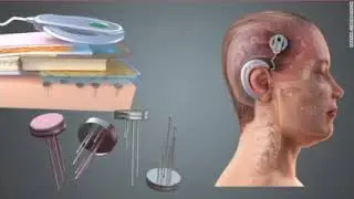 Brain Modulation-Cotter