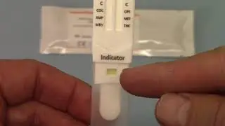 DSD-863/MTD direct saliva screening test demo 1