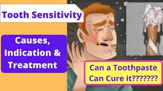 Tooth Sensitivity Causes, Indication, Risk Factor & Treatment-Toothpaste can Cure Tooth Sensitivity?