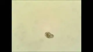 Rotifer Locomotion Video