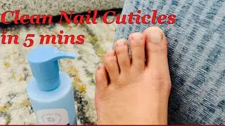 Clean Nail cuticles in 5 mins at home | Pedicure at home