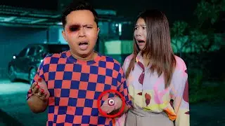 TERJADI SESUATU PADA MATA ZAINAL!! BERDARAH SAMPAI GINI!!