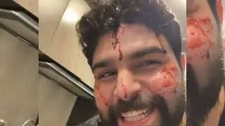 اقوه مقلب مؤتمن بترافولتا 😦 بأربيل ترافولتا زعل وطلع من الفندق 😂