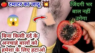टमाटर के रस में इसे मिलाकर लगाया अनचाहे बाल झड़ झड़ के गिरने लगे 😱 Remove facial hair naturally 