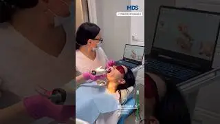 Helios 500 Eighteeth від MDS &mdash; ідеальний інструмент для точності та комфорту у цифровій стоматології