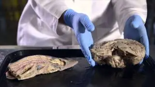 We Are Modified Fish: A History of Human Evolution &mdash; HHMI BioInteractive Video