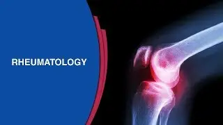 What causes Rheumatoid Arthritis? | Risk Factors Of Rheumatoid Arthritis | Manipal Hospitals