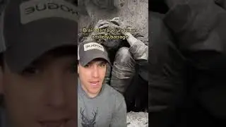 Контузия