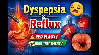 Dyspepsia & Reflux Explained | Causes, Symptoms & Best Treatments
