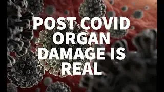 Post Covid Organ Damage