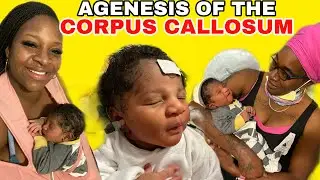 COME WITH PEACH 🍑 MY 6th CHILD IN THE NICU 👶🏾 AGENESIS OF THE CORPUS CALLOSUM (MISSING BRAIN) 🧠