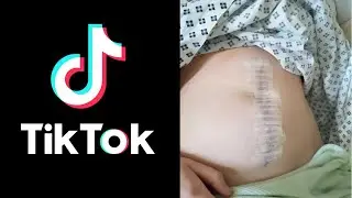 Girl Almost Dies From Tik Tok Trend