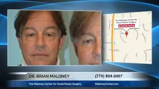 Dr. Brian Maloney  Of The Maloney Center for Facial Plastic Surgery:Tips For Anti-Aging