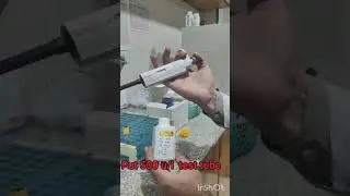 How to perform total bilirubin's  All procedures in this vedio with details