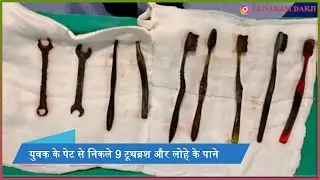 युवक के पेट से निकले 9 टूथब्रश और लोहे के पाने.....