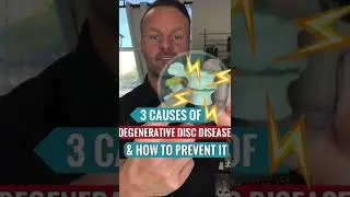 3 Causes of Degenerative Disc Disease and How to Prevent It