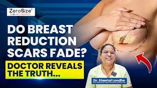 The Ugly Truth About Breast Reduction Scars and Nipple Sensation
