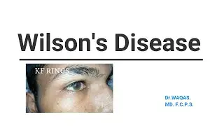 WILSON DISEASE.(Examination Skills)