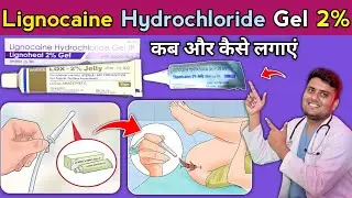सुन्न करने वाली दवा | Lignocaine Hydrochloride Gel 2% | Topical Anaesthesia | Lignocaine gel