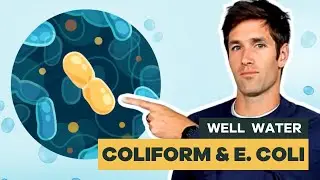 Is Coliform Bacteria Common in Well Water?
