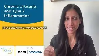 Chronic Urticaria and Type 2 Inflammation! #type2inflammation #chronicurticaria #hives