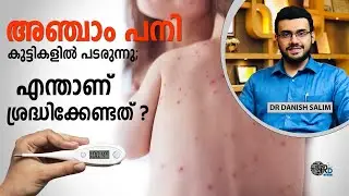 1167:👶കുട്ടികളിൽ അഞ്ചാം പനി. എന്താണ് ചെയ്യേണ്ടത്? Measles is spreading in children,What to be done?