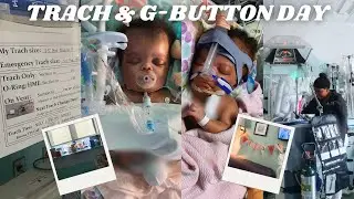MY BABY HAD HER TRACH & G BUTTON SURGERY | BITTERSWEET DAY | TRACH JOURNEY