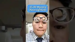 -35.00 D lense for Myopia or Nearsightedness&nbsp;#myopia&nbsp;#nearsighted&nbsp;#nearsightedness&nbsp;#glasses&nbsp;#elklook