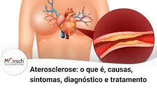 Aterosclerose  o que é, causas, sintomas, diagnóstico e tratamento