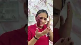 Are Yaar 😭 #shortvideo