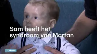 Sam (7 maanden) heeft het zeldzame syndroom van Marfan