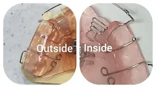 How to make a push spring /loop spring/Orthodontic appliance