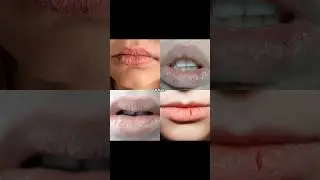 Chapped Lips Solution That Works | Best Lip Care Products You Need #shorts #lipcare #nivea #selfcare
