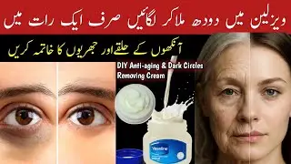 Say Goodbye to Dark Circles Overnight IEasy Home Remedies | Get Rid OF Wrinkles | Anti-Aging Cream