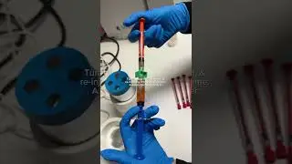 Natural Skin Rejuvenation with PRF EZ Gel