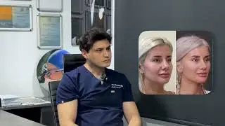 🎥 Dr. Ufuk ile Şakak Germe (Temporal Lift) Ameliyatı Nedir?