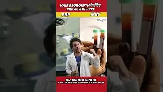 IPRF - PRP से ३ गुना ज़्यादा Hair Regrowth | Hair loss | Hair Fall | Hair Treatment | Adon Hair Care