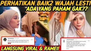 WAJAH LESTI BARU AJA JADI PERHATIAN JUTAAN PUBLIK - LESLAR ENTERTAINMENT TERBARU, LESTI BILLAR