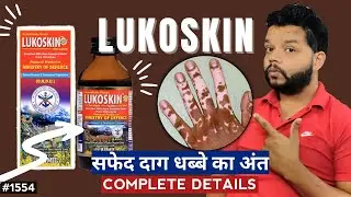 सफेद दाग धब्बे हटाने की दवा | Aimil Lukoskin Syrup Review | Medicine For Vitilgo And Leucoderma