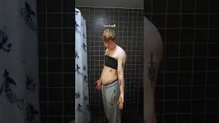 The reality of top surgery recovery..🏳️&zwj;⚧️ #transman #ftm
