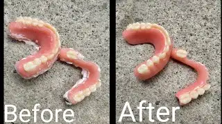 TRIMMING DENTURES...
