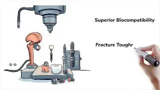 Why Grade 23 Titanium Is the Gold Standard for Medical & Aerospace!