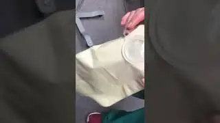 Urostomy Bryce Yacos