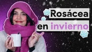 SALVADORES de la ROSÁCEA en invierno. Tips para armar tu rutina y más!