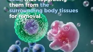 Liposuction surgery expert in Makati || Dr. Claudine Roura