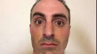Second example of nasal breathing without using nasal muscles