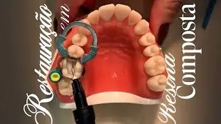 Come with me to make a class II resin restoration composite with the horizontal technique.