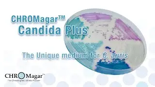 CHROMagar Candida Plus, the Unique medium for C. auris