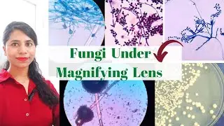 How do you identify fungi under a microscope? | LPCB stain | Do fungi show up on Gram stain?