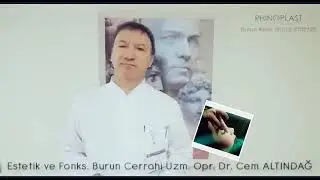 Thinking About Rhinoplasty? Meet Dr. Cem Altındağ - 26 Years Experience | The Nose Clinic Istanbul